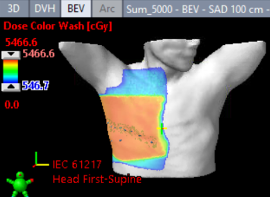 Cherenkov imaging of FLASH radiation delivery.