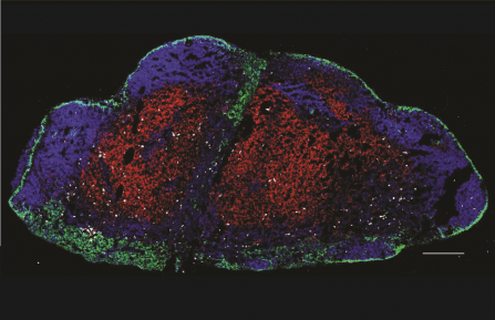 lymph node T cells