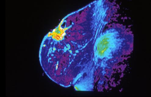 Breast imagery