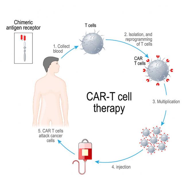 CAR T-Cell Therapy | Blood And Marrow Transplantation Program ...